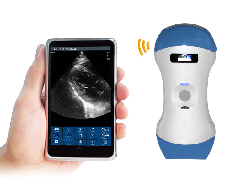 5CPL Wireless Probe Handheld Color Doppler Ultrasound, Convex Array/Linear Array/Phased Array Three-in-One