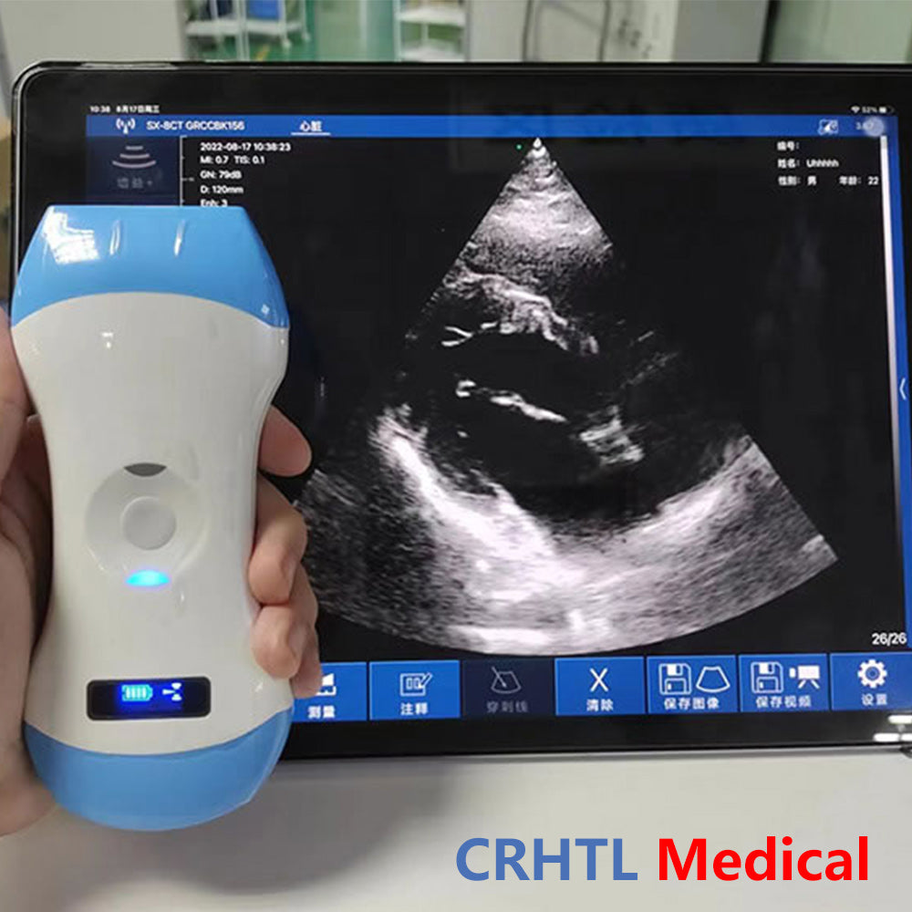 Ultrasonido portátil 3 en 1 con sonda inalámbrica y wifi, compatible con iOS, Android y Windows.